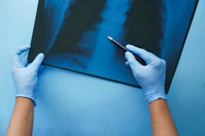 lung disease