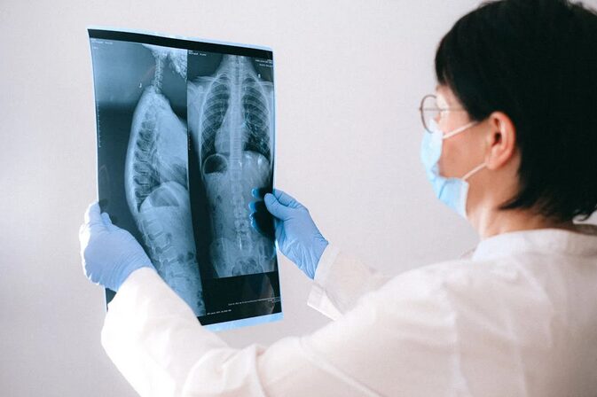 lung scan